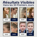 POMMEAU DE DOUCHE FILTRANT - ÔFILTRE